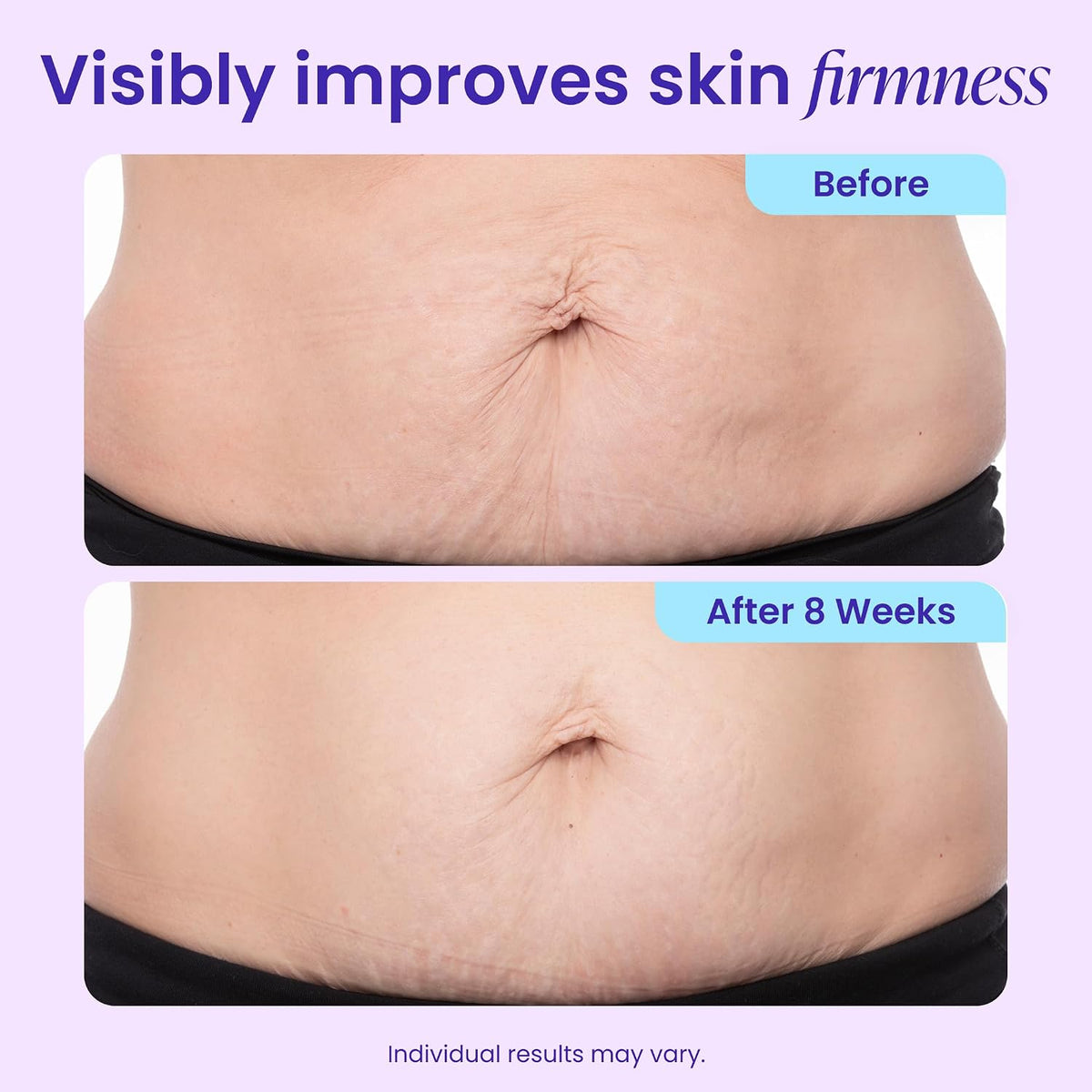 Tighten & Smooth Belly Firming Cream