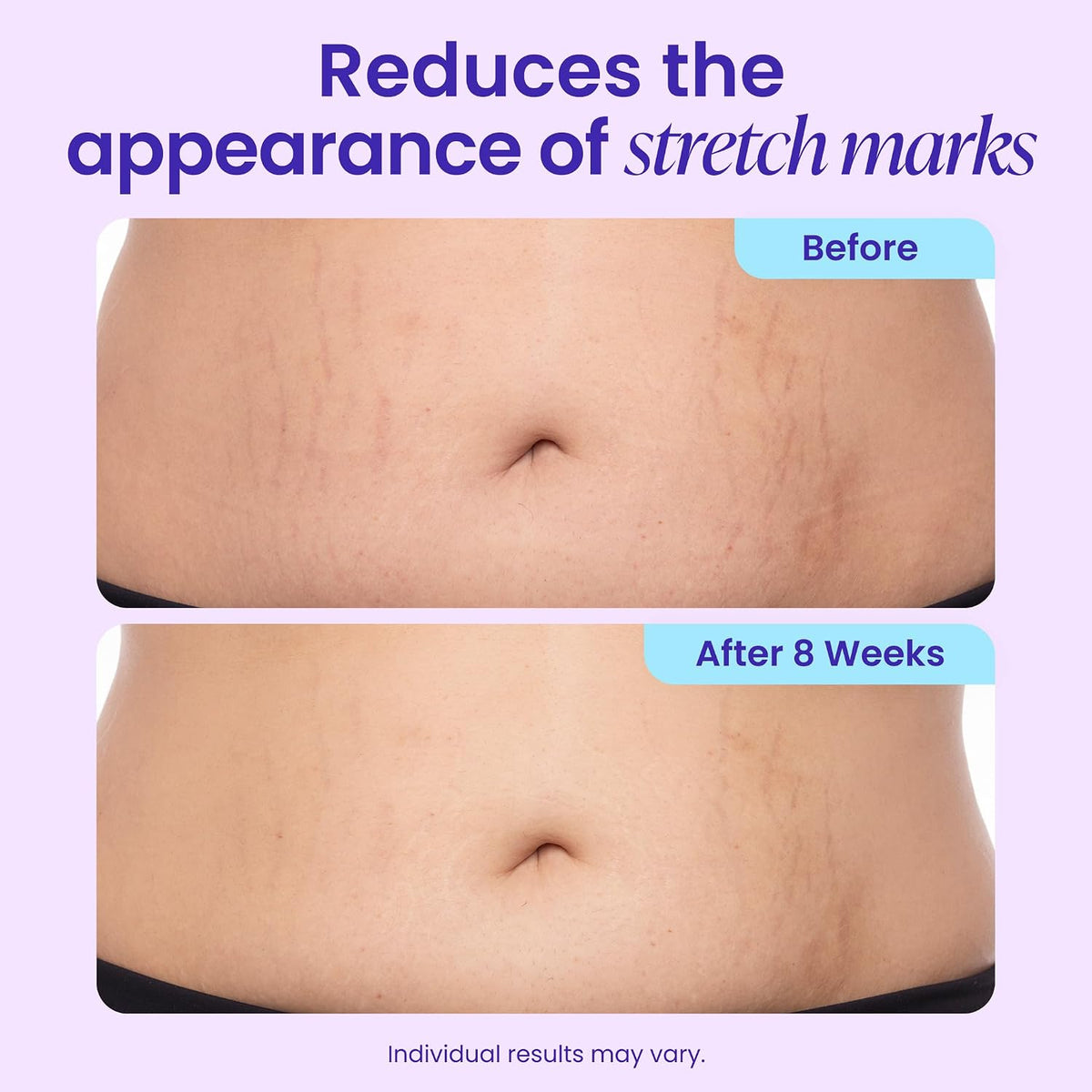 Tighten & Smooth Belly Firming Cream