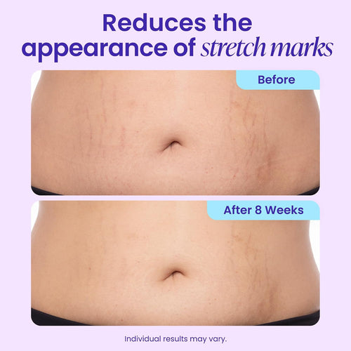 Tighten & Smooth Belly Firming Cream